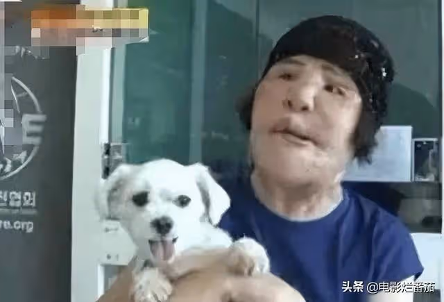 整容成癮韓慧景：把臉整得面目全非，給自己注射機油，後悔莫及