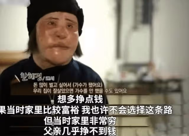 整容成癮韓慧景：把臉整得面目全非，給自己注射機油，後悔莫及