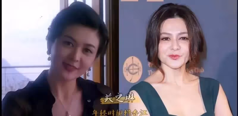 8位「膠面」港星,臉僵如蠟像,五官怪異,個個「面容不再自然」