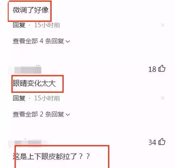 徐若瑄近照大變樣,雙眼皮太寬,意外撞臉王心淩,被網友嘲笑蛤蟆成精