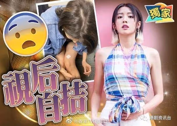 TVB當紅花旦獻身自扎!「學醫」再沖視後殊榮
