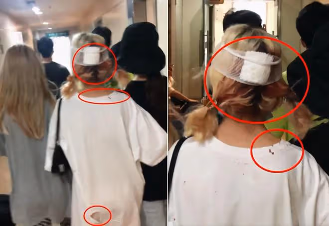 女星趙敏雅遭家暴!被打到休克,向前男友求救