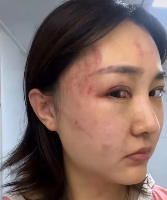 韓星趙敏雅也難逃家暴，被打到窒息求救前男友，丈夫是健身房CEO
