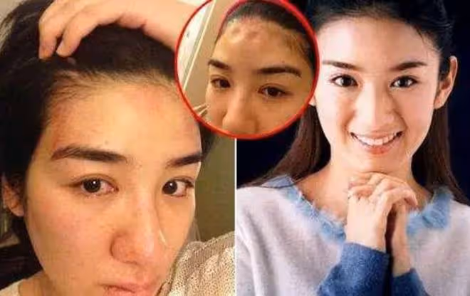 韓星趙敏雅也難逃家暴，被打到窒息求救前男友，丈夫是健身房CEO