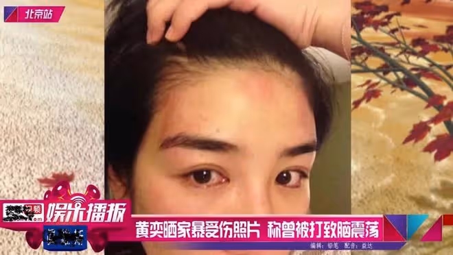 劈腿、20個攝像頭、鎖女友在家,這些女星都攤上了渣男前任