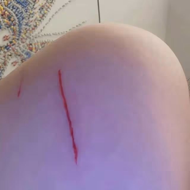 突發!香港知名女星被豹貓抓傷血痕累累,緊急就醫打破傷風針
