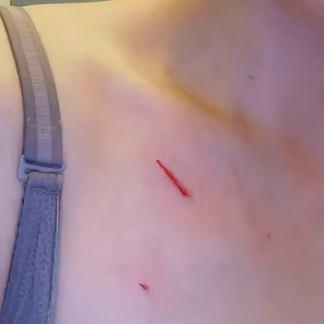突發!香港知名女星被豹貓抓傷血痕累累,緊急就醫打破傷風針