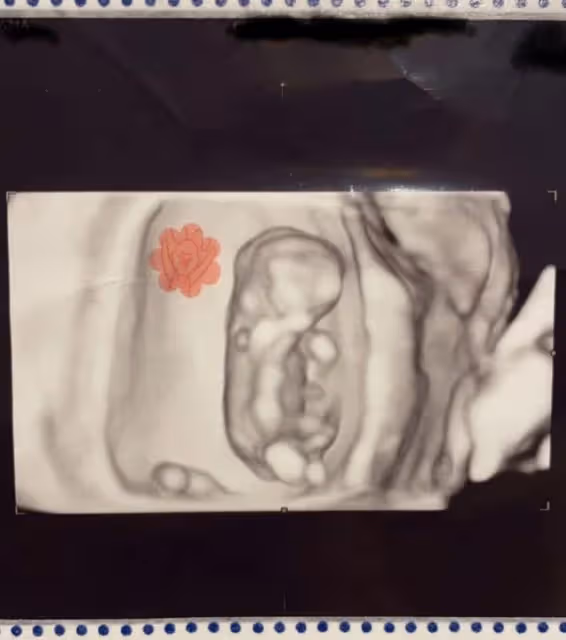 恭喜！香港知名老戲骨女兒宣布平安誕男嬰，產後恢復迅速面色紅潤