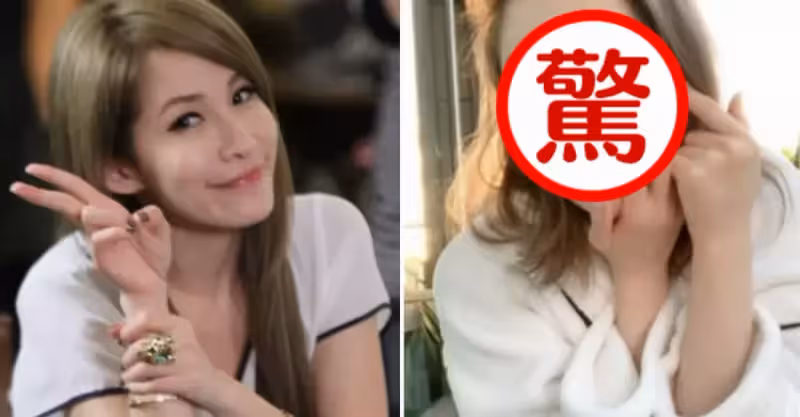 蕭亞軒素顏直播公開右臉傷疤，臉部消瘦面容憔悴，肌膚光滑無瑕疵：42歲美貌依舊在線