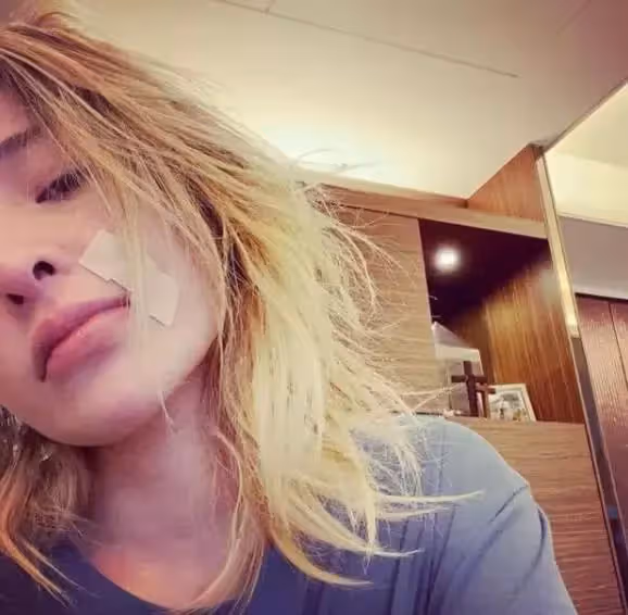 蕭亞軒素顏直播公開右臉傷疤,臉部消瘦面容憔悴,肌膚光滑無瑕疵:42歲美貌依舊在線