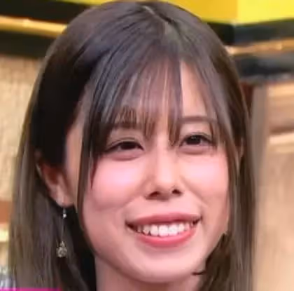 自卑到不敢笑!暴牙凸嘴女星「被酸長得像蟑螂」 砸100萬整形變「甜美大眼正妹」網驚:笑容好美