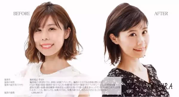 自卑到不敢笑!暴牙凸嘴女星「被酸長得像蟑螂」 砸100萬整形變「甜美大眼正妹」網驚:笑容好美