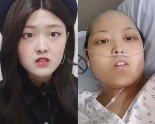 韓國網紅患卵巢癌病逝!年僅23歲,最後露面曝光已瘦骨嶙峋