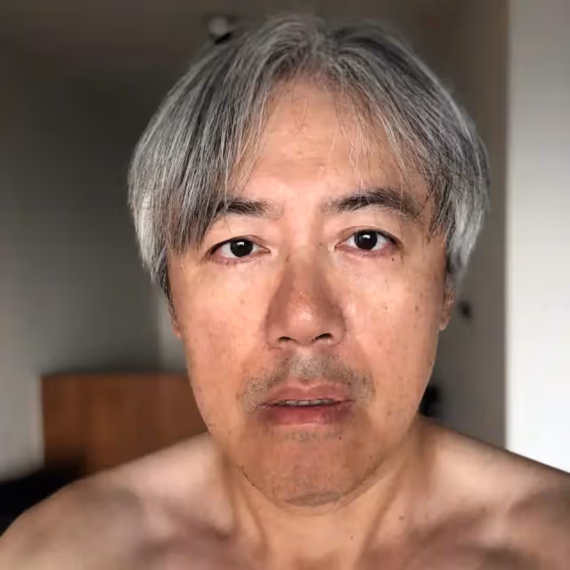 歌手張宇將妻子緊急送醫!太太十一郎遭遇醫療疏忽,藥物過敏致呼吸困難,現已沒有大礙,曾坦言「近些年小病不斷」