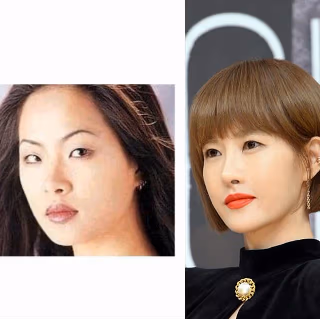 金三順變臉史,43歲做哪些改造才變成這張網紅臉,要向現實低頭啊
