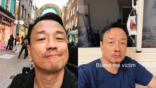 黃秋生台灣做PCR檢測　像王喜一樣被捅到出血