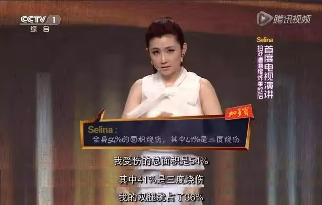 燒傷、離婚、失聲之後,她要再婚了?