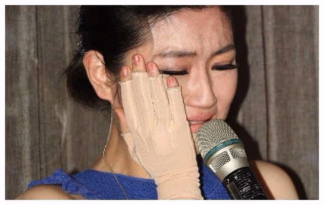 娶了毀容後的Selina，看似感情很好，張承中卻說：自己想吐