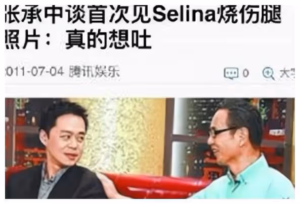 娶了毀容後的Selina，看似感情很好，張承中卻說：自己想吐