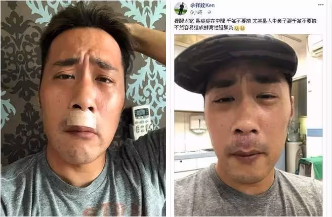 又長了5顆腫瘤？余苑綺癌末急搶救，餘祥銓痛曝最新病況，網都哭了