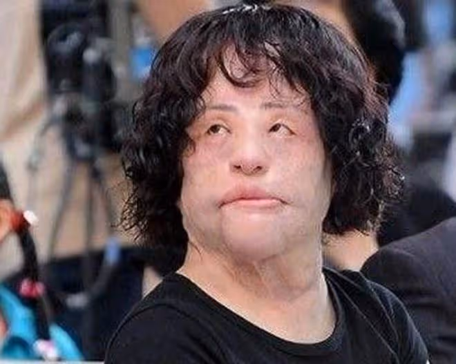 她天生麗質卻痴戀整容，後因意外導致毀容，去世時年僅57歲