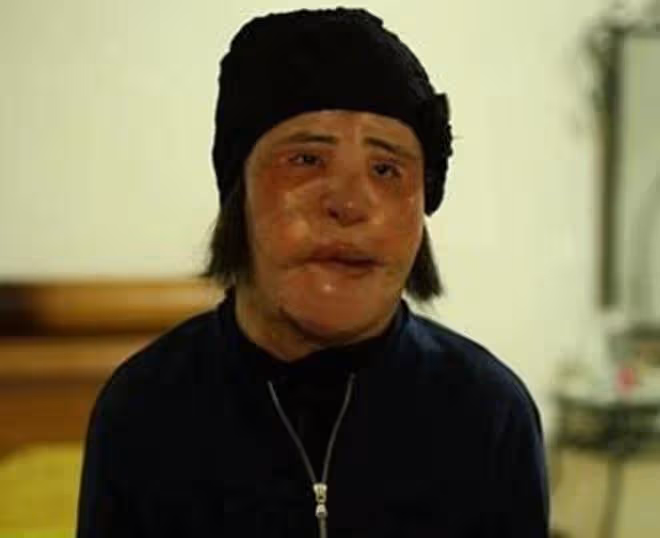 她天生麗質卻痴戀整容，後因意外導致毀容，去世時年僅57歲