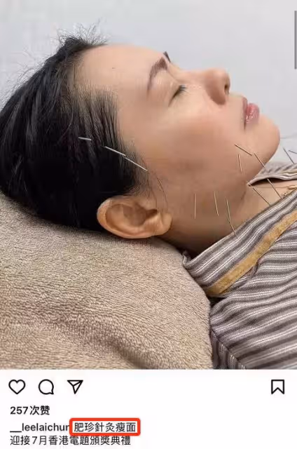 56歲李麗珍曬照,昔日性感女神「肥又老」,為減肥臉上扎14針