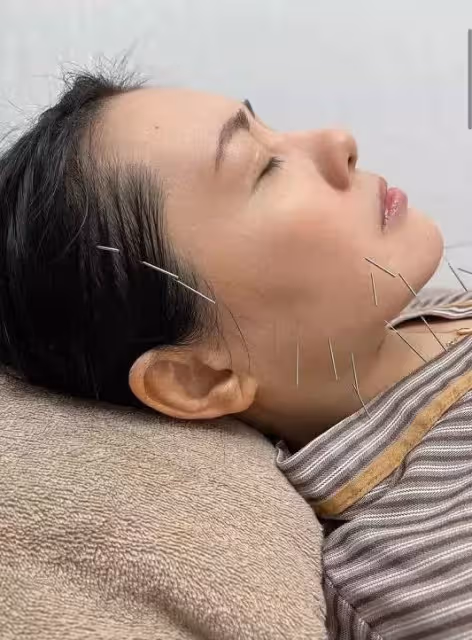 56歲李麗珍曬照,昔日性感女神「肥又老」,為減肥臉上扎14針