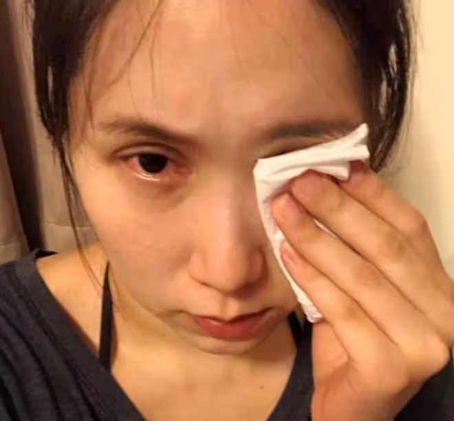 38歲抗癌女星化療70次後病情再惡化，腫瘤變大三倍，肺內異物爆開