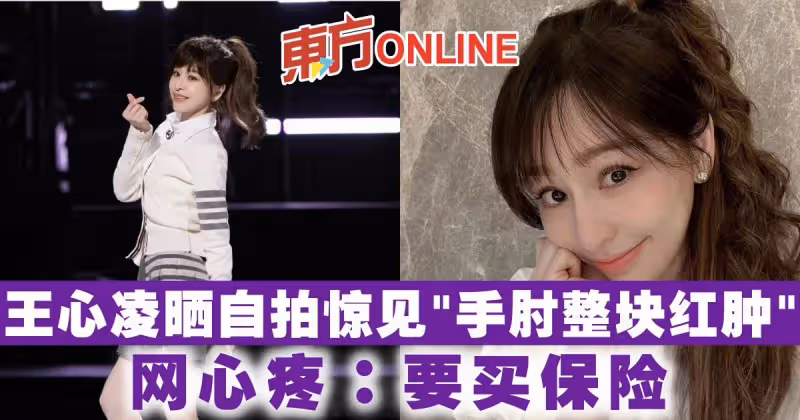 王心凌曬自拍驚見「手肘整塊紅腫」　網心疼：要買保險