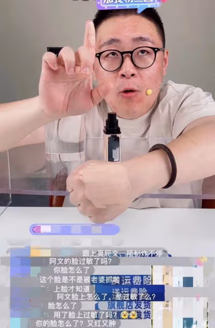 郝劭文掙錢養家太拼了,面部紅腫堅持直播,網友:老婆抓了?