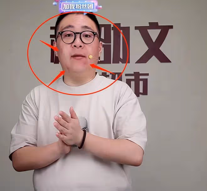郝劭文掙錢養家太拼了,面部紅腫堅持直播,網友:老婆抓了?