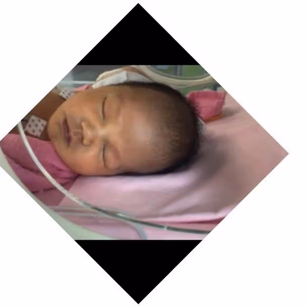 張致恆老婆早產誕第三胎　寶寶要插胃喉