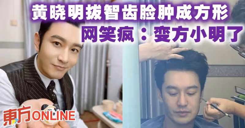 黃曉明拔智齒臉腫成方形　網笑瘋：變方小明了