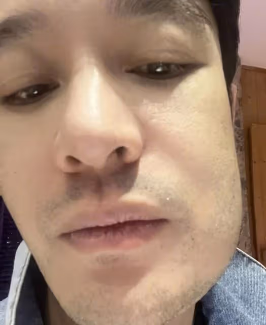 黃曉明拔智齒臉腫成方形　網笑瘋：變方小明了