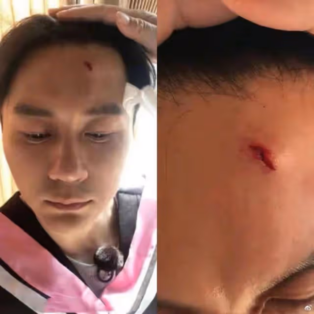 任魯豫錄製節目意外摔傷,背部著地傷情嚴重,仍堅持錄製態度敬業