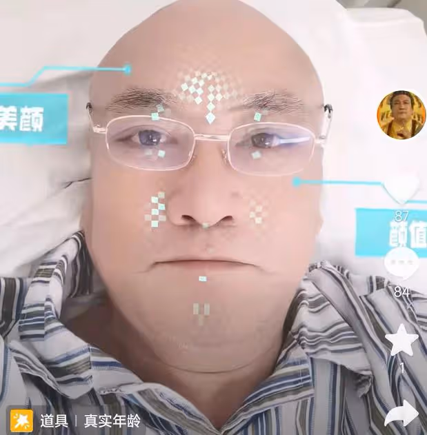 64歲資深戲骨緊急入院,躺病床上做心臟支架面色蒼白,曾扮演如來