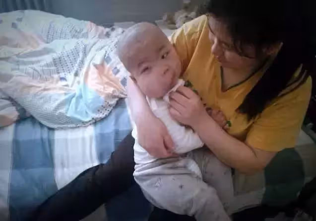 2歲男童患重病,臉頰腫大如嬰兒頭。媽媽:沒有錢就只能等死嗎?