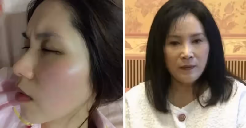 余苑綺罹癌再手術！李亞萍悲曝「併發腎積水」最近病況曝光　臉暴瘦凹陷「像是骷髏人」癌細胞來不及殺
