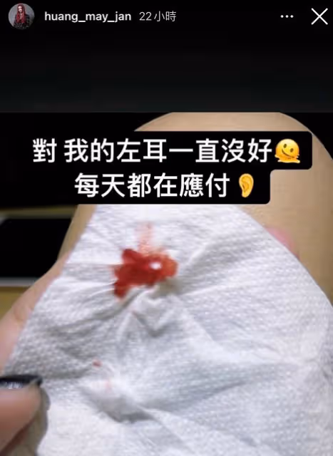39歲女歌手聽力只剩兩成,左耳時常出血,此前還患恐慌症長達14年