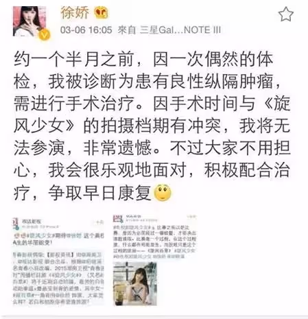 周星馳乾女兒徐嬌長大了,一身寬鬆衛衣玩「下衣失蹤」,淡妝出鏡五官精緻甜美,開網店吸金無數:少女初長成