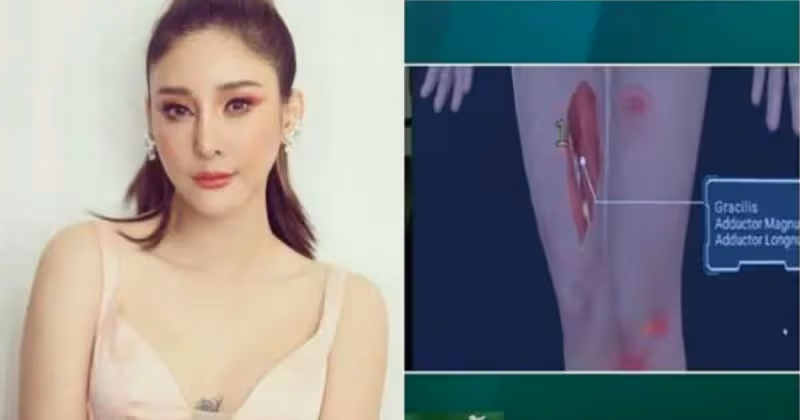 泰女星Tangmo溺斃「眼球凸出」　脖子驚見勒痕肺胃滿是泥巴