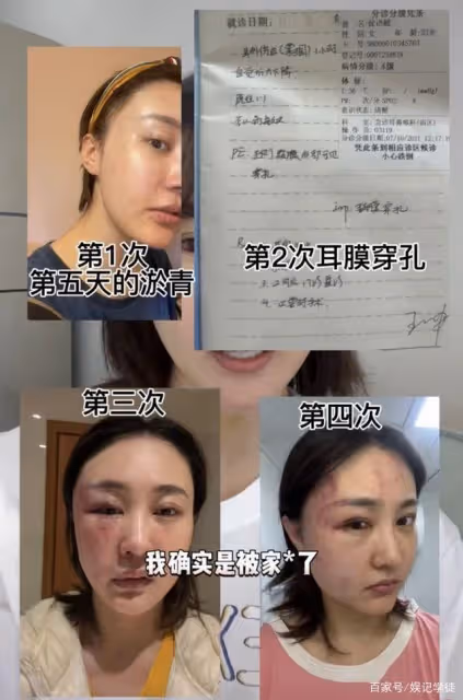 遭小10歲丈夫砍殺險喪命!40歲女星身份疑似曝光