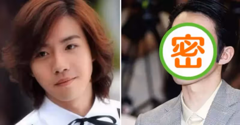 20歲爆紅，22歲意外燒傷毀容，被女友分手被吐槽相貌，如今成功逆襲：實力派演員