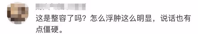 王石愛妻田朴珺陷整容爭議,生圖變化大被指臉腫僵硬,有怪異凹陷
