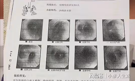 著名主持人劉振亞,突發心源性猝死,疑似責任醫院用藥不當!