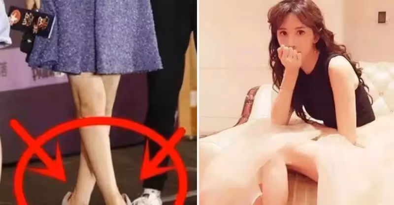 女明星的腳也是「千奇百怪」！林志玲42碼大腳讓人吃驚，趙麗穎無鞋可穿