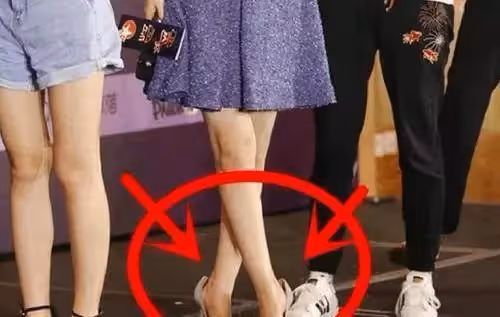 女明星的腳也是「千奇百怪」！林志玲42碼大腳讓人吃驚，趙麗穎無鞋可穿
