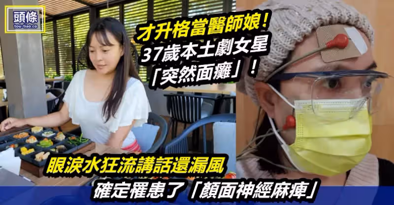 才升格當醫師娘！37歲本土劇女星「突然面癱」！眼淚水狂流講話還漏風　確定罹患了「顏面神經麻痺」