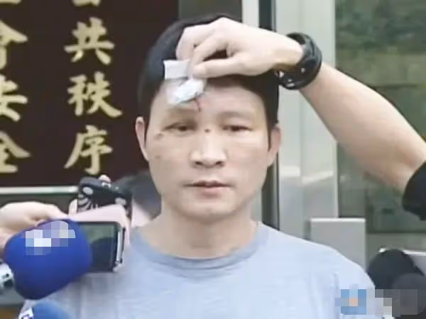 52歲戲骨被控欠債157萬,無奈直播變賣家產,此前暴瘦肺部長異物